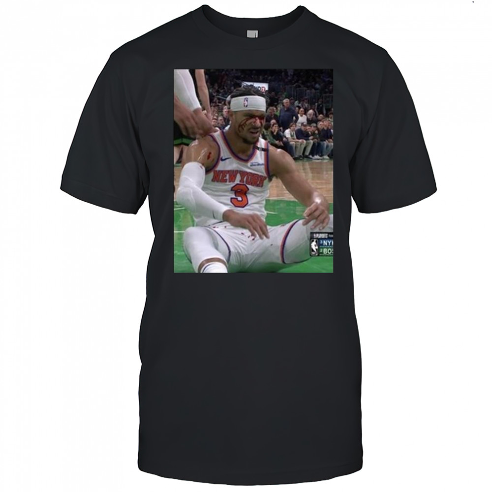 Photos Of Josh Hart After Getting Elbowed In The Face New York Knicks t-shirt