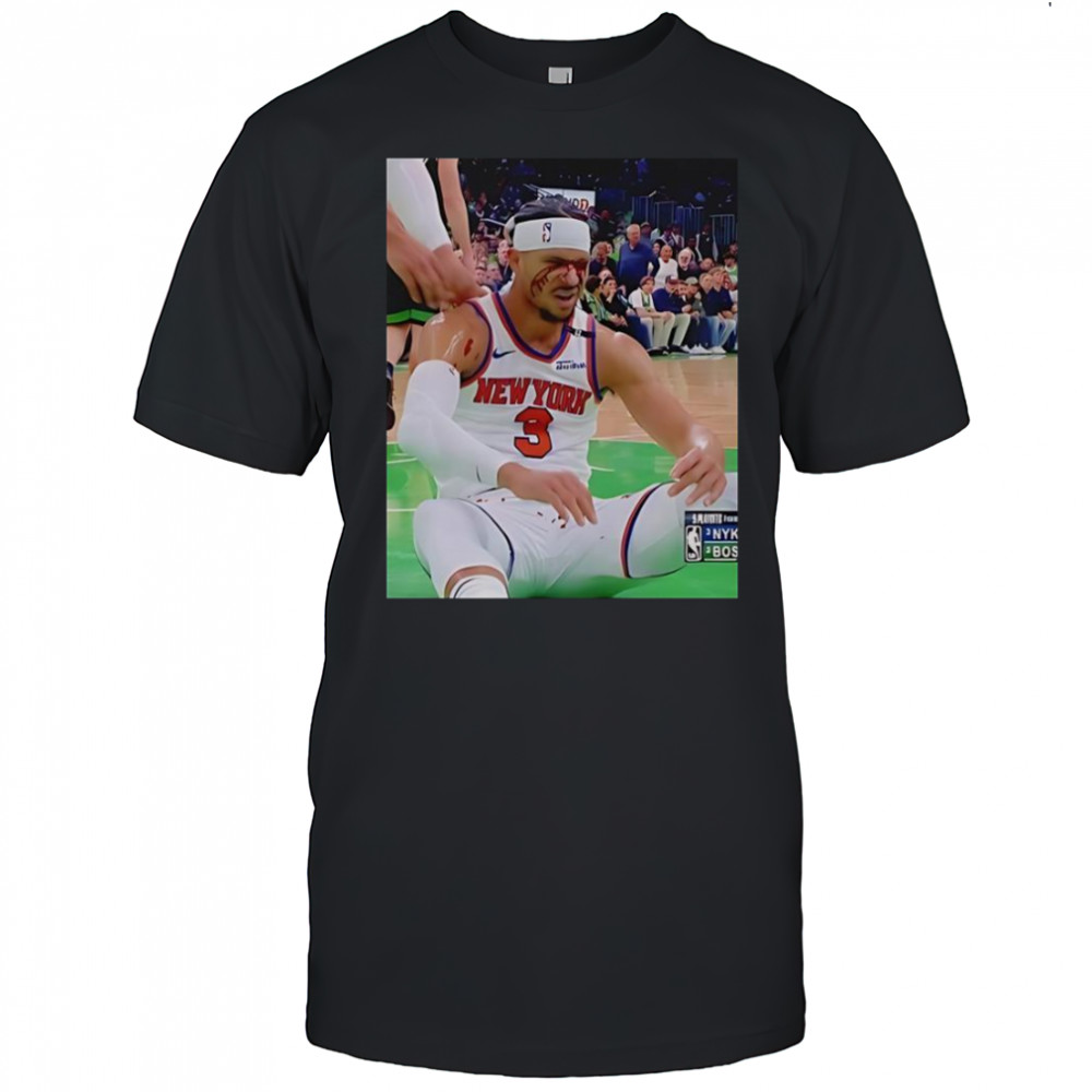 Photos Of Josh Hart After Getting Elbowed In The Face T-Shirt