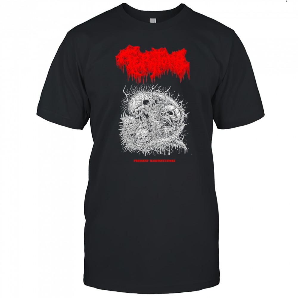 Teratoma Manifestations T-shirt
