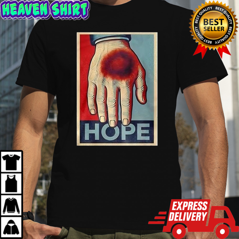 Donald Trump bruise hand Hope shirt